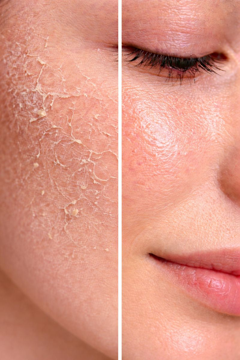 Combination Skin Routine