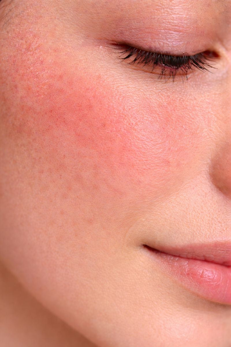 Sensitive Skin Routine (Minimalist)